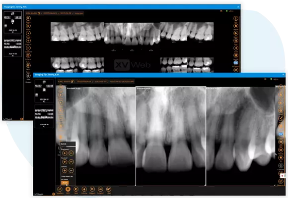 Screenshots of digital FMX mount and x-ray manipulation tools