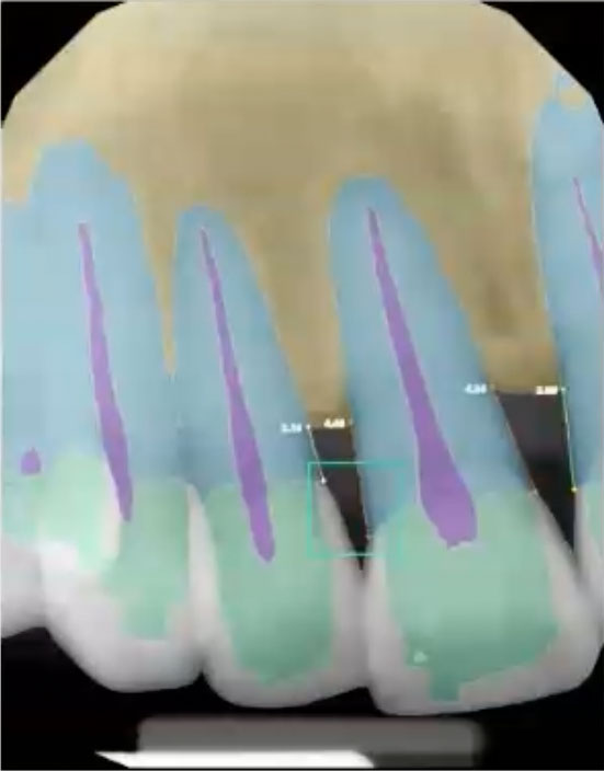 ThriveCloud AI x-ray features on tablet